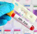 HIV-Positive London Man Cured of AIDS Virus after Bone Marrow Transplant