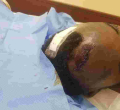 Senator Anwar Loitiptip Admitted to ICU After Attack by Armed Men at a Nairobi Club