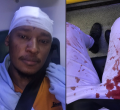 Kenyan Gay Man Attacked by Fellow Kenyans in London