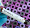 Kenyan Woman Who Arrived in Nairobi from the US Tests Positive for Coronavirus, Kenya’s First Case