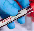 15 Kenyans, One Foreigner Test Positive for Covid-19