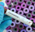 Kenya’s Coronavirus Cases Top 5,000 as Death Toll Hits 130