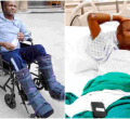 MP Moses Kuria Starts Walking Again After 4 Months in the Hospital, 10 Surgeries 