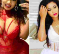 I'm Lucky to Be Alive, Vera Sidika Says As She Undergoes Corrective Surgery After Body Enhancement Complications 