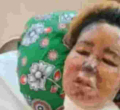 Mombasa Woman Fights for Her Life After Boyfriend Scalds Her Face with Boiling Oil 