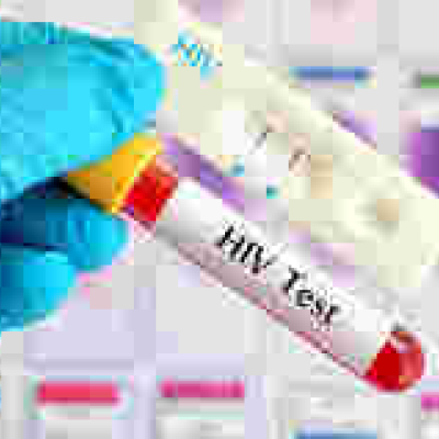 HIV-Positive London Man Cured of AIDS Virus after Bone Marrow Transplant