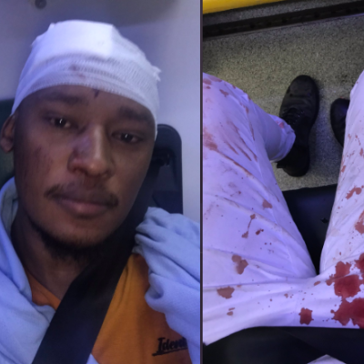 Kenyan Gay Man Attacked by Fellow Kenyans in London