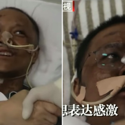 Chinese Doctors' Skin Color Turn Black after Recovering from Covid-19