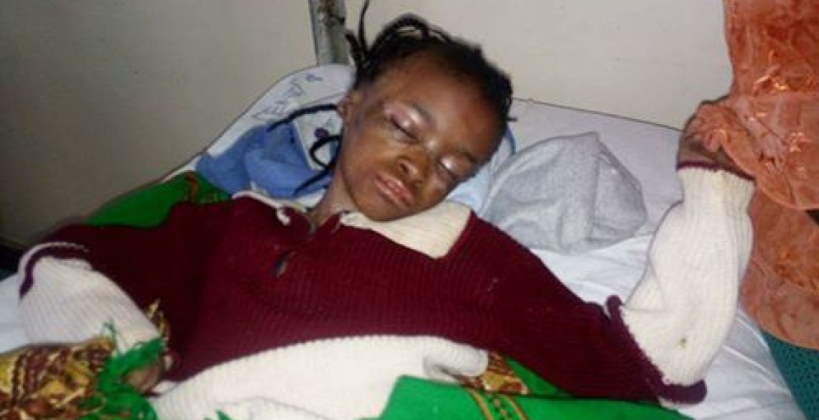 Kenyans Raise Sh4.2 Million in 45 Hours in Solidarity with Girl with Rare Disease