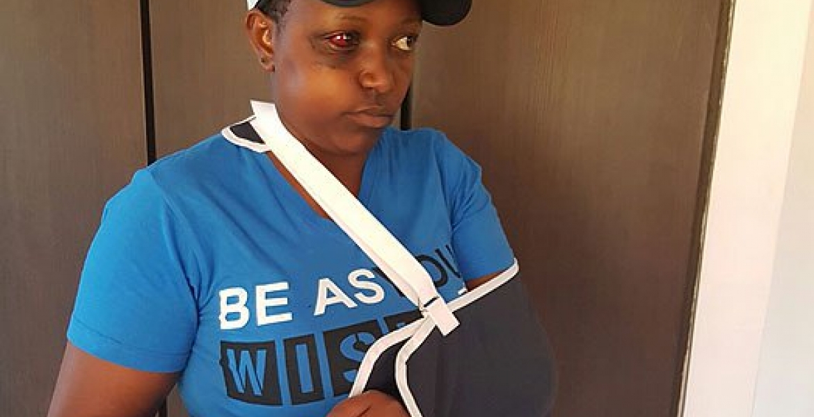 Female Nyeri MCA Sustains Serious Injuries after Male Colleague Hits Her with a Beer Bottle During Bench-Marking Tour in Tanzania