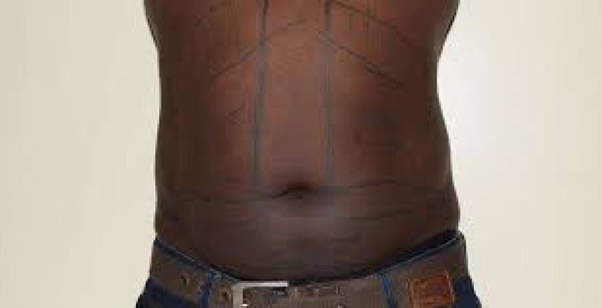 Number of Kenyan Men Seeking Belly Fat Removal Grow