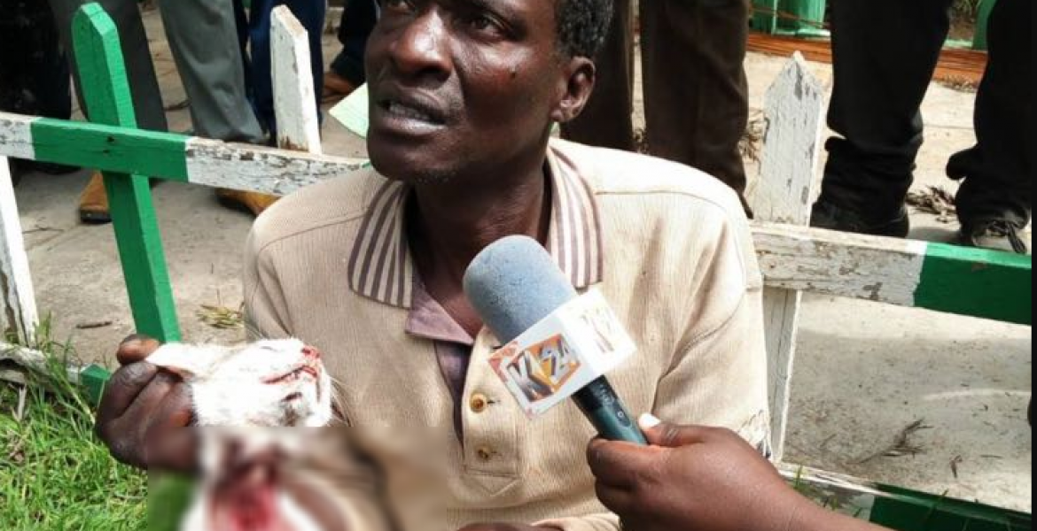 Kenyan Man Admits to Skinning 1,000 Cats, Selling Meat