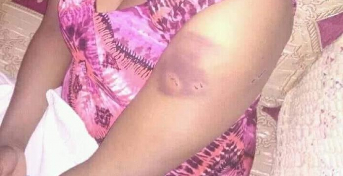 Githunguri MP Gabriel Kago Accused of Assaulting His Wife Using Hot Iron Box