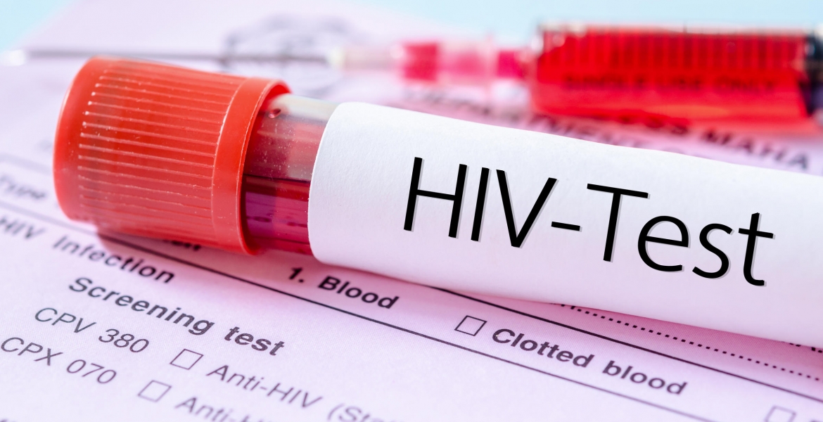 More Than 4,000 Homosexuals in Kilifi Infected with HIV, Official Says
