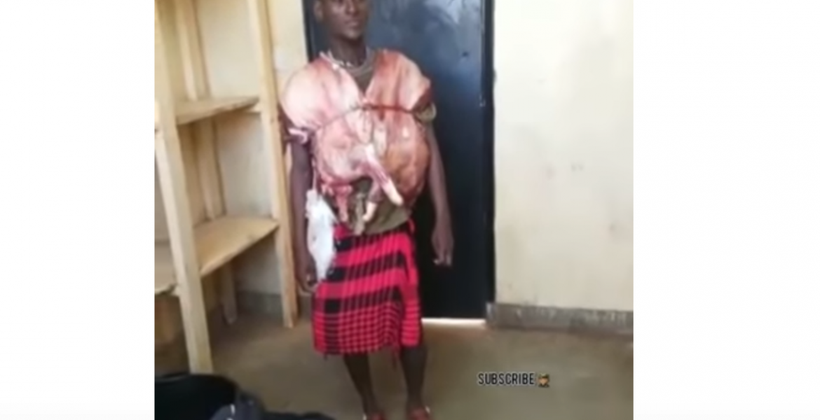 Kenyan Man Caught with Slaughtered Goat Hidden Underneath His Clothing [VIDEO]