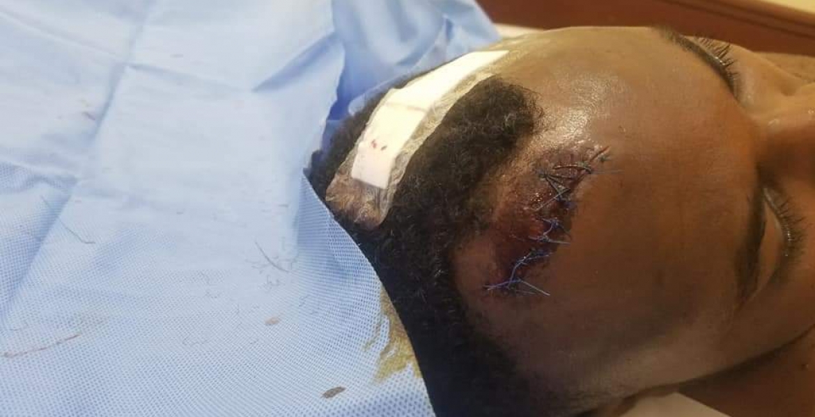 Senator Anwar Loitiptip Admitted to ICU After Attack by Armed Men at a Nairobi Club