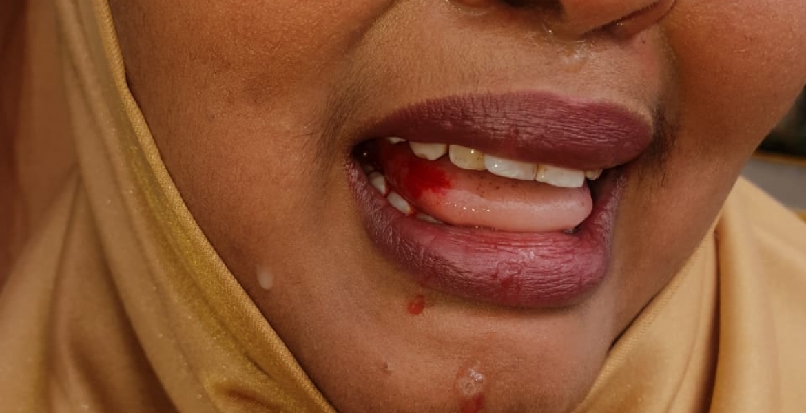 MP Rashid Kassim Attacks Wajir Woman Rep. Fatuma Gedi in Parliament