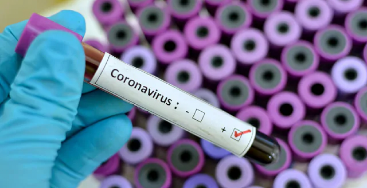 Kenyan Woman Who Arrived in Nairobi from the US Tests Positive for Coronavirus, Kenya’s First Case