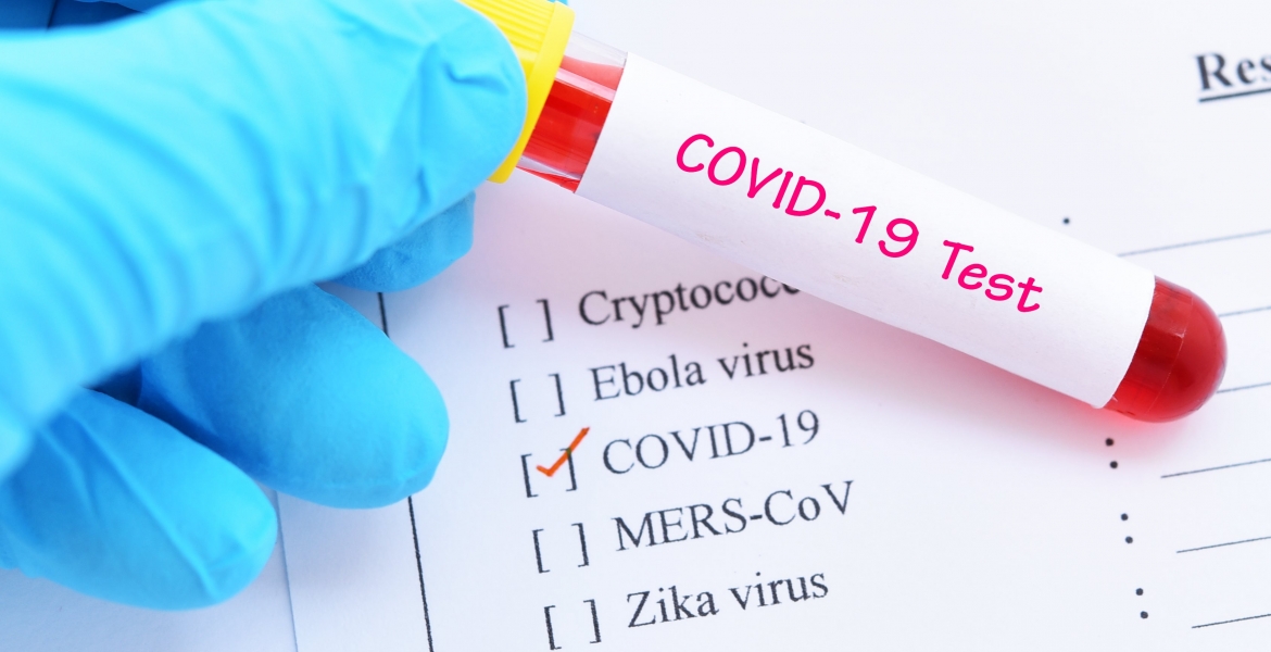 Authorities Raid Nairobi Clinic Claiming to Sell Coronavirus Test Kits for Sh3,000