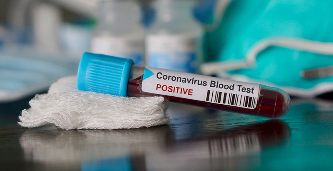 Ugandan Man, Daughter Arrested with Alleged Coronavirus ‘Vaccine’