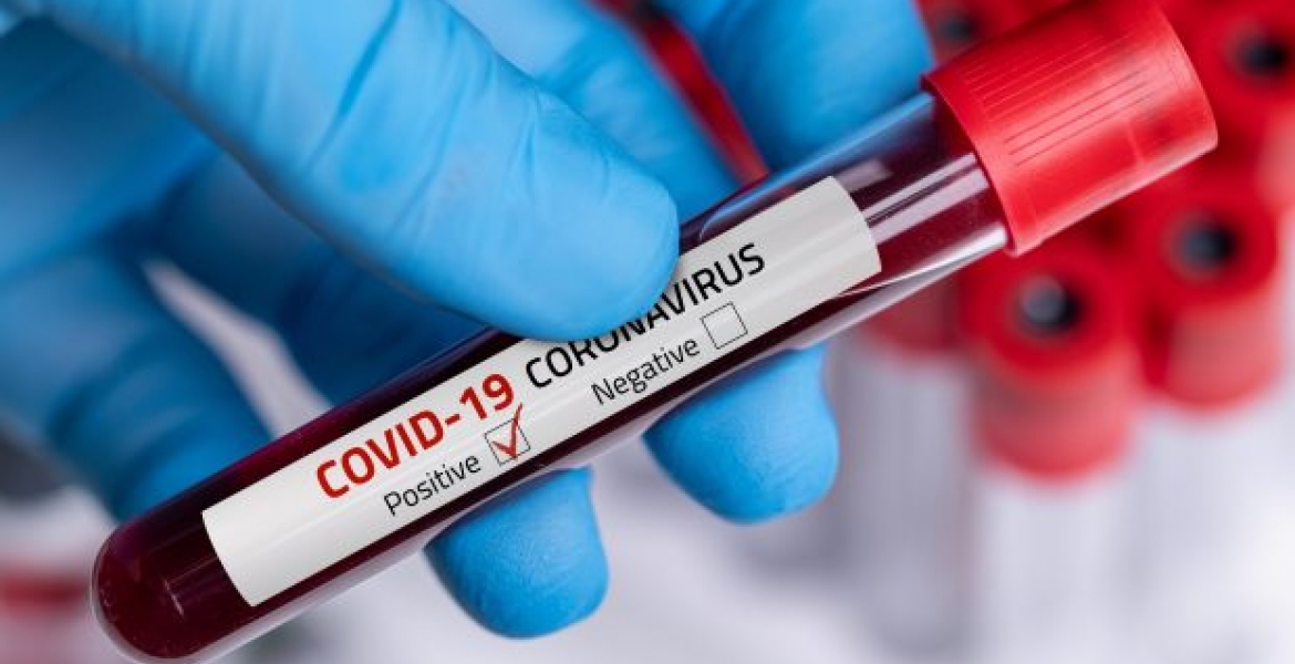 Eight More People Test Positive for Covid-19 in Kenya, Tally Rises to 216