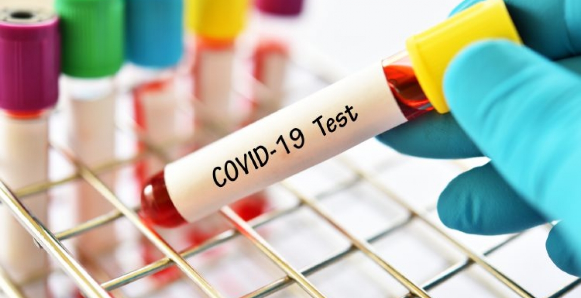 Confusion as Kenyan Who Tested Positive for Covid-19 in Uganda Gets Negative Result in Kenya