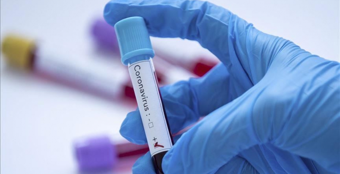 Kenyan Scientists to Conduct Trial for Three Possible Covid-19 Drugs