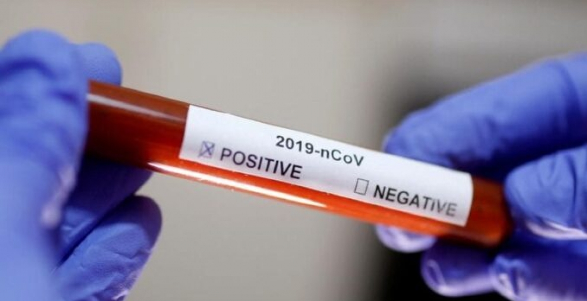 Covid-19 Cases in Kenya Surpass 8,000 as Death Toll Hits 164