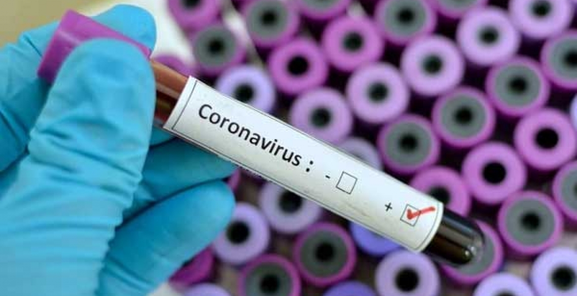 Kenya’s Daily Covid-19 Death Toll Surpasses 20