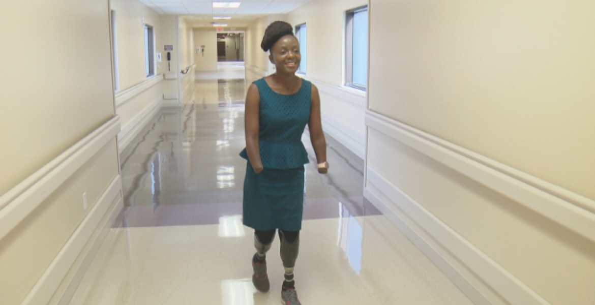 How Victoria Mugo, a Kenyan Woman in the US, Lost All Her Hands and Legs