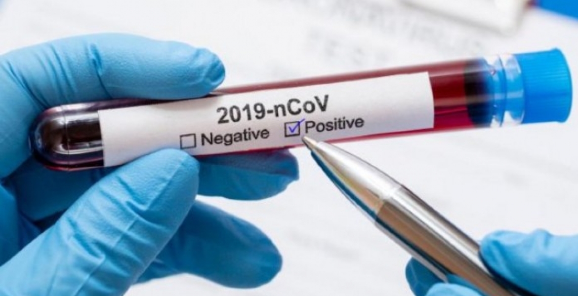 All Devolution Ministry Employees Sent to Isolation After 18 Test Positive for Covid-19