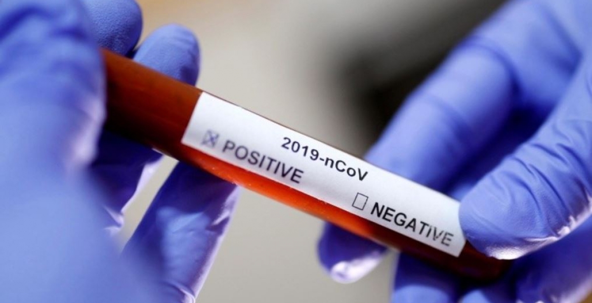 Kenya’s Daily Covid-19 New Cases Fall Below 100 as 83 Test Positive