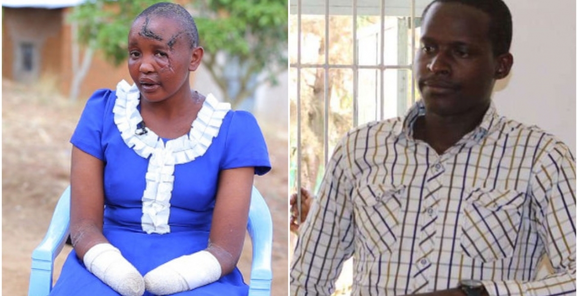 Kenyan Man Who Chopped Off Wife's Hands Sentenced to 30 Years in Prison