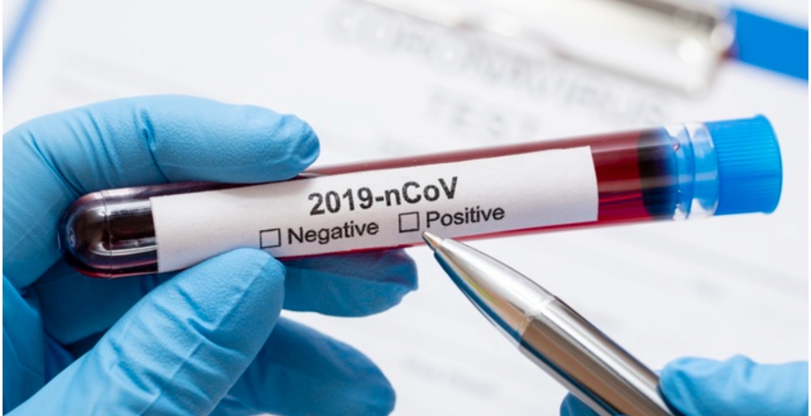 Kenya Detects Five Cases of Deadly COVID-19 Variant from India