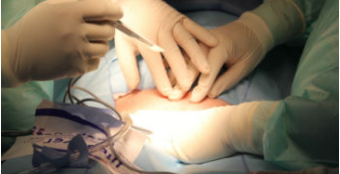 Catholic Priest Undergoes First Successful Heart Valve Transplant in Kenya