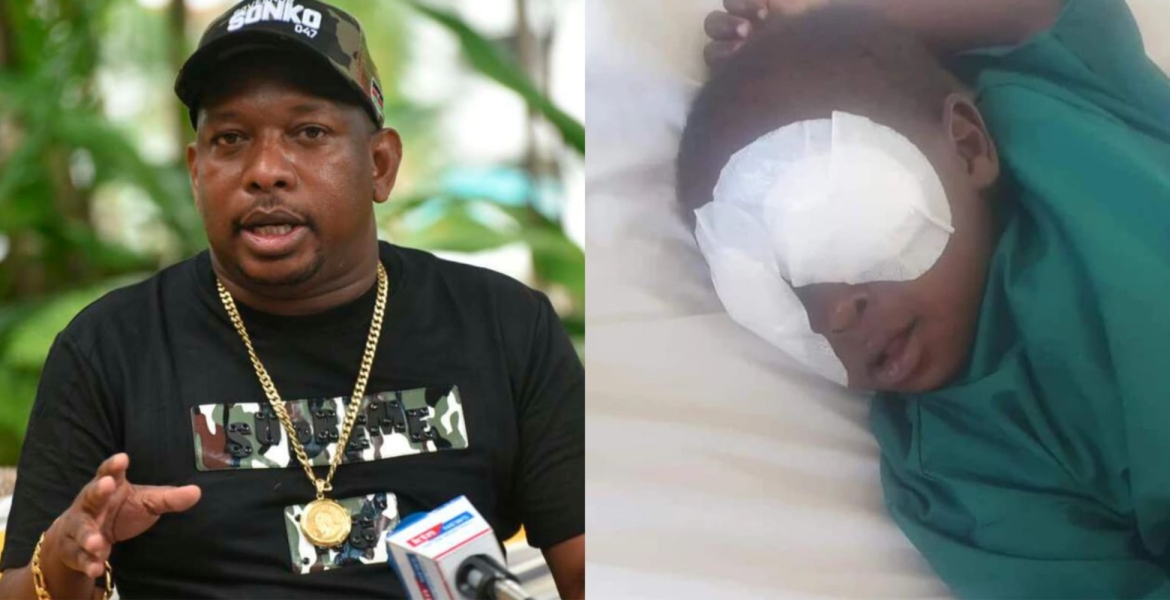 Sonko Offers to Fly Baby Sagini to South China for Eye Implants