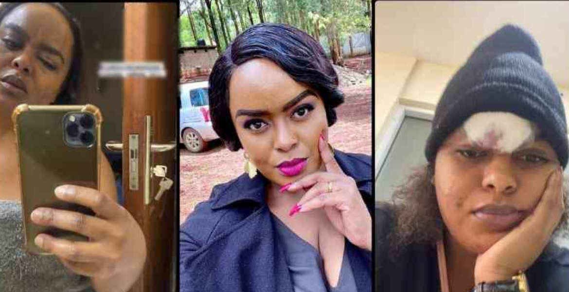 Singer Avril's Bruised Selfies Go Viral, Prompting Anger and Calls for Accountability