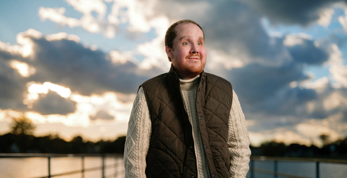 Derek Pfaff How 80 Surgeons Rebuilt a Human Face in 50 Hours After Suicide Attempt