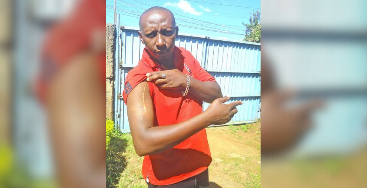 Kiambu Man Shot 13 Times Defies the Odds, Rebuilds Life After Deadly Attack